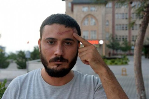 Devre mülk kirasını almaya gittiler, darp iddiasıyla şikayetçi oldular