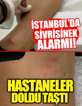 İstanbul'da sivrisinek alarmı! Vatandaş hastaneye koştu!