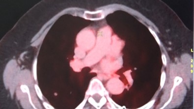 Diyarbakir'da Kanser Hastalari Son Nükleer Tip Teknolojileriyle Sifa Buluyor