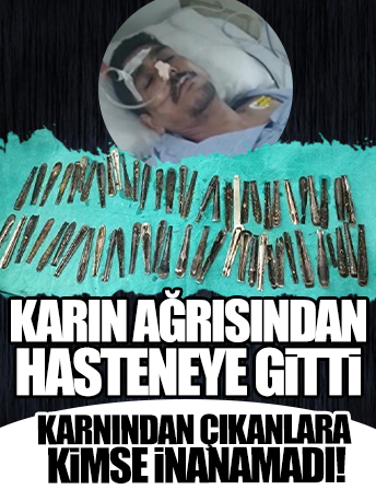 Karnı ağrıyan adamın midesinden 63 kaşık çıktı