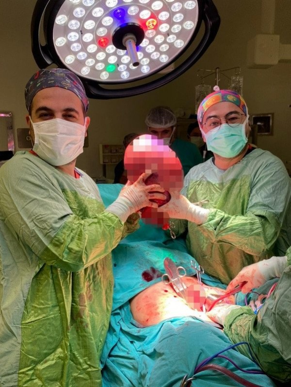Karnını kaplayan kitle, operasyonla çıkartıldı. Karnından çıkanı görünce gözlerine inanamadı.