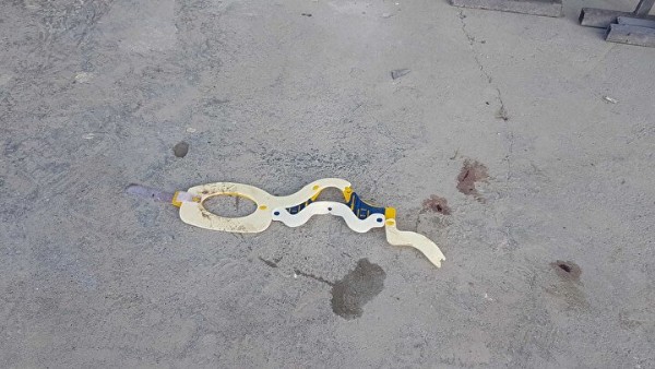 Sakarya'da 13 yaşındaki çocuk feci şekilde can verdi: Acı gerçek kahretti