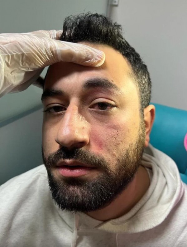 Elazığ'da randevuya geç kalan hasta, doktoru darbetti