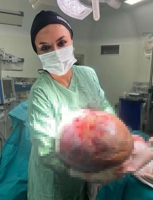 Kadın hastanın karnından çıktı: Tam 20 kilo! Doktorlar gözlerine inanamadı!
