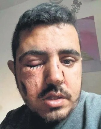 Kan emici Siyonist! Gazze'de sivillerin yaşadığı binalar hedef alındı, 300 nokta vuruldu