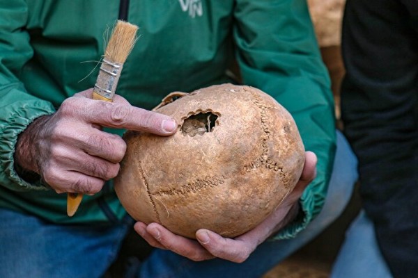 Van'da önemli keşif: 3 bin 200 yıllık alanda 'beyin ameliyatı' izleri