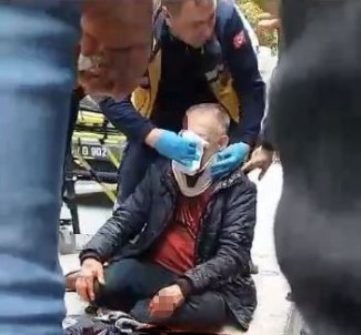 Usak'ta Motosikletin Çarptigi Yaya Agir Yaralandi