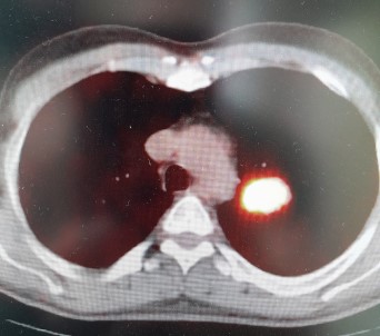 Prof. Dr. Sevket Özkaya Açiklamasi 'Yasayan Her Hücrenin Sonu Kanser'