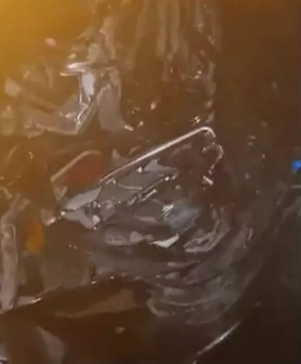 Mehmet Ali Erbil trafik kazası geçirdi