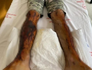 İstanbul'da dehşeti yaşadı! Lavabosunu açmak istedi, ölüyordu...