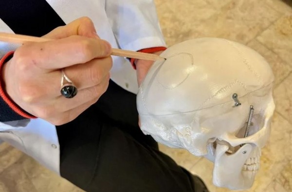 8 bin 500 yıllık keşif! Çatalhöyük’te tespit edildi: Acıyı ve ağrıyı dindirmek için yaptıkları şaşırttı