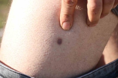 Babadan Kalan Miras, Kardesi Agabeye Vurdurttu