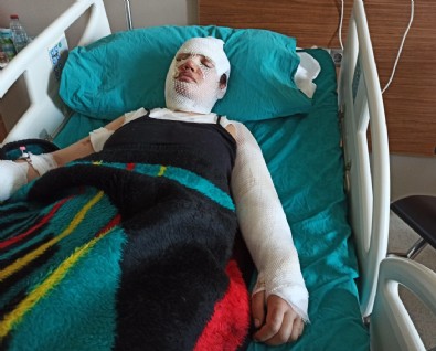 Depremzede eski eşini kaynar suyla yaktı! İfadesi pes dedirtti: 'Artçı sarsıntı nedeniyle oldu'