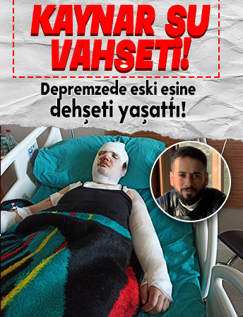 Depremzede eski eşini kaynar suyla yaktı! İfadesi pes dedirtti: 'Artçı sarsıntı nedeniyle oldu'