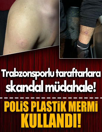 Trabzonsporlu taraftarlar Basel'de saldırıya uğradı