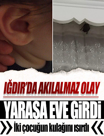 Iğdır'da akılalmaz olay: Eve giren yarasa iki çocuğu ısırdı