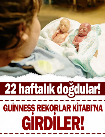 Dünyanın en erken doğan ikizleri Guinness Rekorlar Kitabı'nda