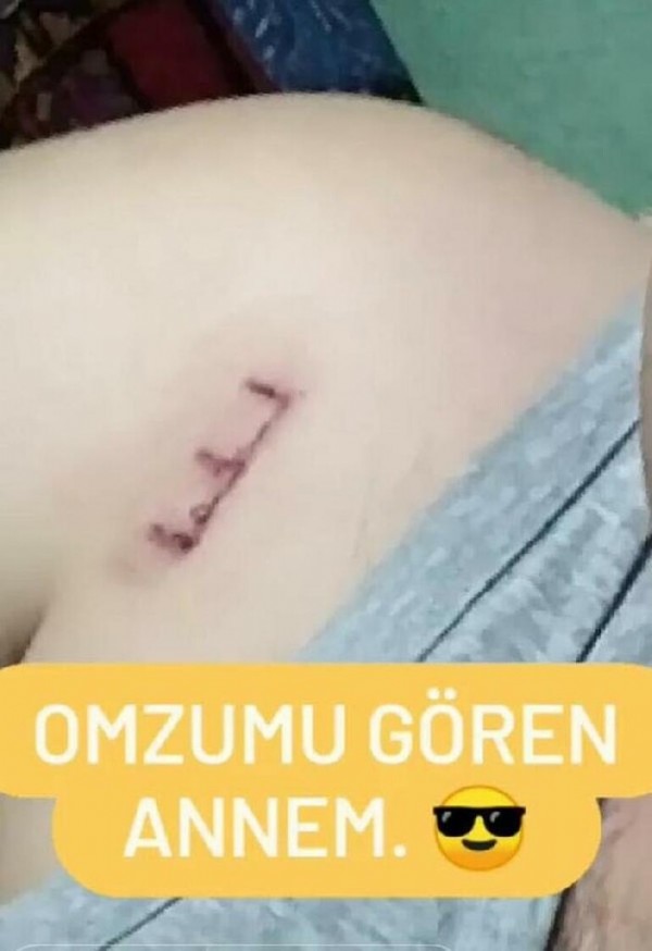 Konya'da kuzeninin evlilik teklifini reddedince vurulan Emine Hemşire öldü