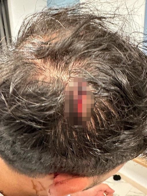 AK Parti seçim otobüsüne saldırı: PKK sloganları attılar Başkan Erdoğan'a hakaret ettiler!