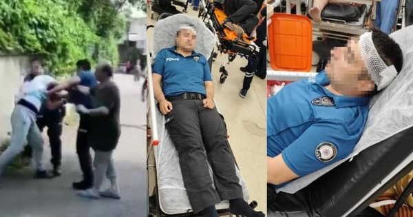 İstanbul'da dehşet anları: Polisi taşla yaraladı!