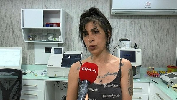 Bursa’da hayvan vahşeti! Yavru köpeğin ayaklarını kesip yaktılar