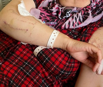 Evin Elektrigini Kesip Kapiyi Açtiran Esi Tarafindan 24 Yerinden Biçaklandigi Anlari Gözyaslari Içinde Anlatti