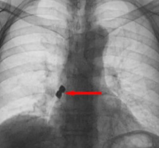 Dis Tedavisinde Hastanin Basina Geleni Duyanlar Sasti Kaldi