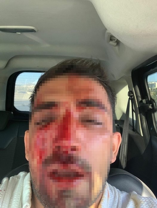 Trafikte muşta ve sopalı vahşet: 50 kişi birden saldırdılar!