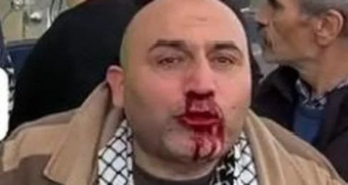 Filistin’e destek mitinginin dönüşünde saldırıya uğradı