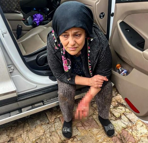 Saldırgan köpek dehşeti! Antalya'da yumurta toplayan kadına doberman saldırdı...