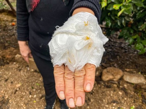 Saldırgan köpek dehşeti! Antalya'da yumurta toplayan kadına doberman saldırdı...