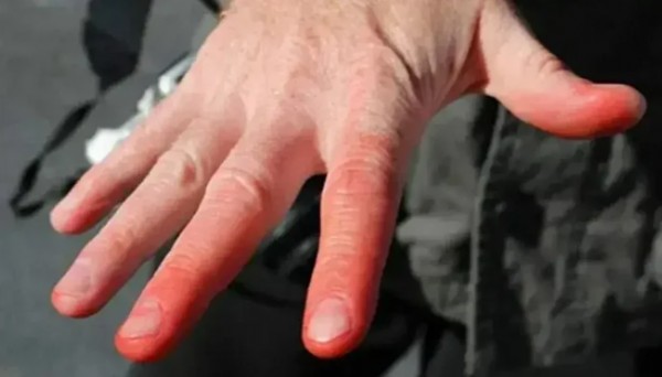 ABD'ye kutup soğukları geliyor! Uzmanlar 'soğuk ısırması'na karşı uyardı: 10 dakika bile yetiyor