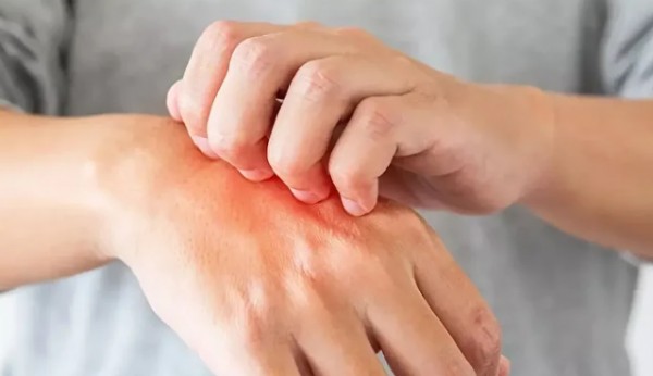 ABD'ye kutup soğukları geliyor! Uzmanlar 'soğuk ısırması'na karşı uyardı: 10 dakika bile yetiyor