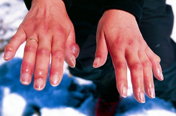 ABD'ye kutup soğukları geliyor! Uzmanlar 'soğuk ısırması'na karşı uyardı: 10 dakika bile yetiyor