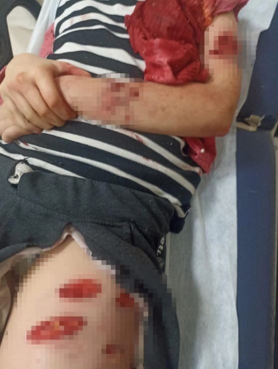 Şanlıurfa'da sokak köpeği saldırısı! Küçük kızı parçaladılar