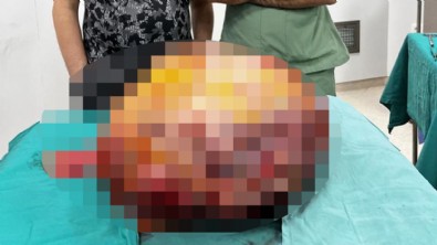 Karın ağrısı şikayetiyle gitti! Tam 26 kilogramlık...