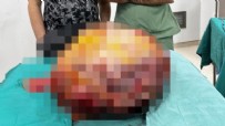 Karın ağrısı şikayetiyle gitti! Tam 26 kilogramlık...