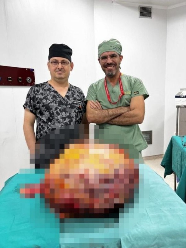 Karın ağrısı şikayetiyle gitti! Tam 26 kilogramlık...