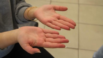 Uzman uyardı! Parmaklarda soğukluk hissine dikkat