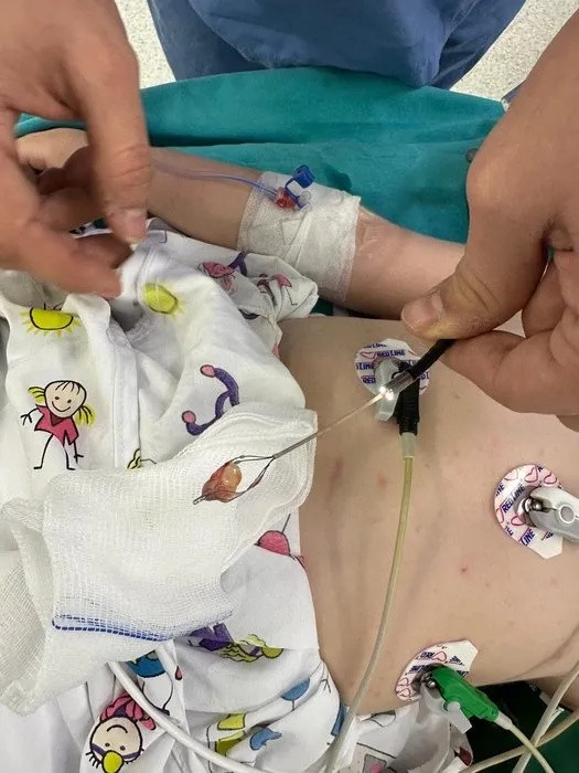 1,5 aydır öksürüyordu doktorlar bile şoke oldu: Hepsi akciğerinden çıktı!