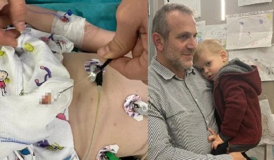 1,5 aydır öksürüyordu doktorlar bile şoke oldu: Hepsi akciğerinden çıktı!