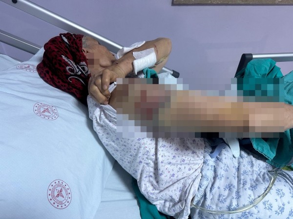 Tunceli'de köpek dehşeti! Yaşlı kadına 7 köpek saldırdı