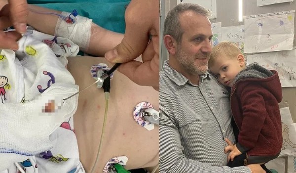 1,5 aydır öksürüyordu doktorlar bile şoke oldu: Hepsi akciğerinden çıktı!