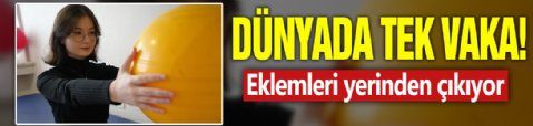 Dünyada tek vaka! Eklemleri yerinden çıkıyor