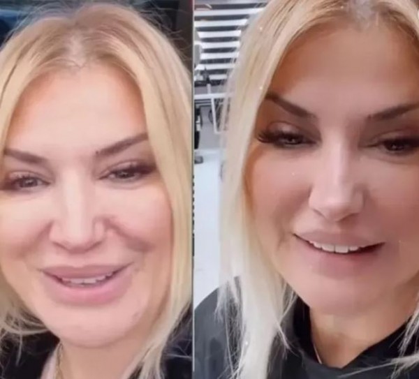 Estetik tutkunu Songül Karlı cesaretini konuşturdu! Filtresiz haliyle meydan okudu!