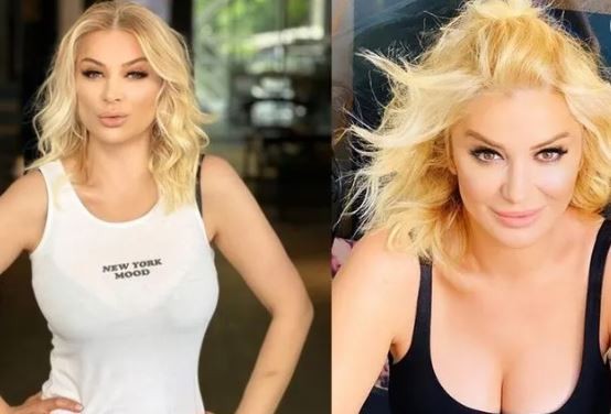 Estetik tutkunu Songül Karlı cesaretini konuşturdu! Filtresiz haliyle meydan okudu!