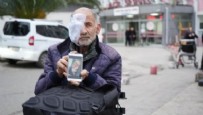 Sinop'ta korkunç hastalık: 65 yaşındaki adamın yüzü eriyor