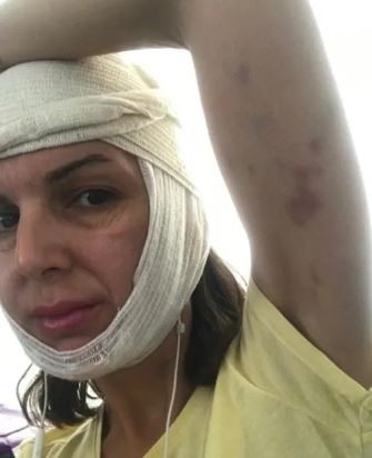 Topuklu ayakkabı sesine kızıp estestisyene kabusu yaşattı: Dükkanın kapısını kilitleyip 20 dakika boyunca…