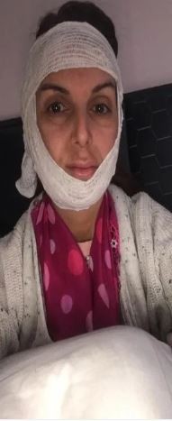 Topuklu ayakkabı sesine kızıp estestisyene kabusu yaşattı: Dükkanın kapısını kilitleyip 20 dakika boyunca…