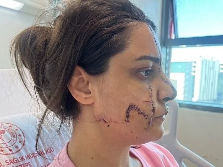 Marmaray’daki saldırganın ağaçtaki görüntüsü ortaya çıktı: Tırmanıp taciz etti!